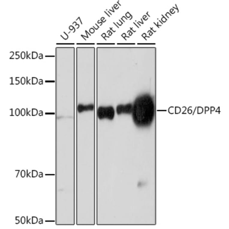 Western Blot - Anti-DPP4 Antibody [ARC0939] (A308878) - Antibodies.com