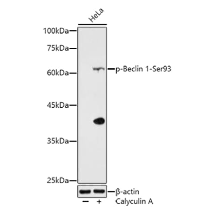 Western Blot - Anti-Beclin 1 (phospho Ser93) Antibody (A308879) - Antibodies.com