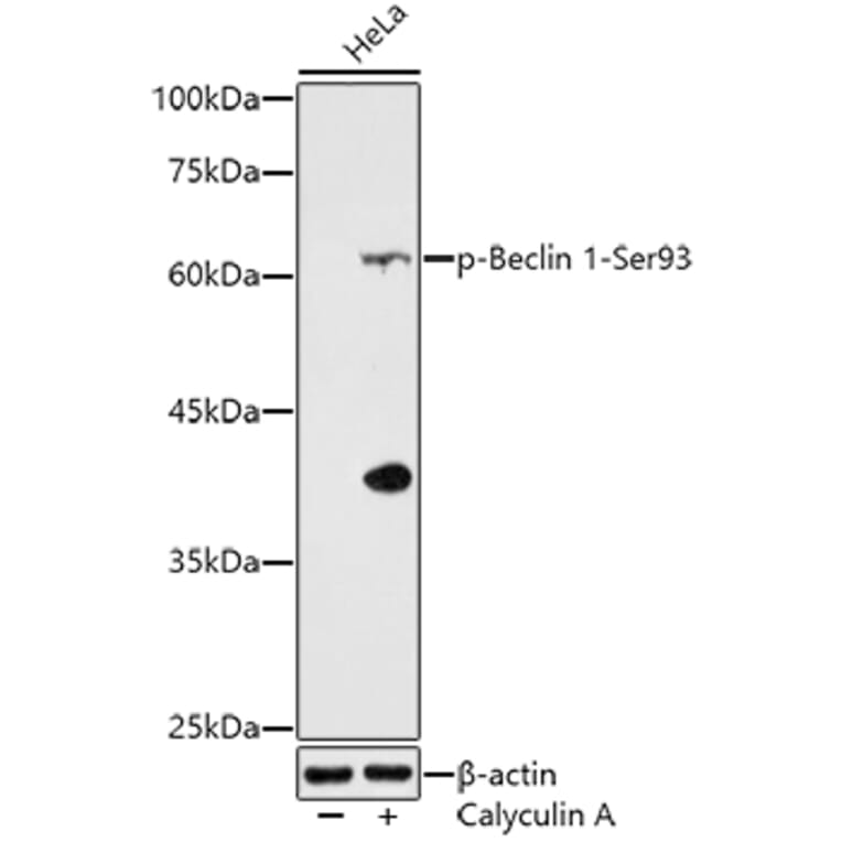 Western Blot - Anti-Beclin 1 (phospho Ser93) Antibody (A308879) - Antibodies.com
