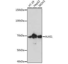 Western Blot - Anti-Alas1 Antibody [ARC0239] (A308881) - Antibodies.com