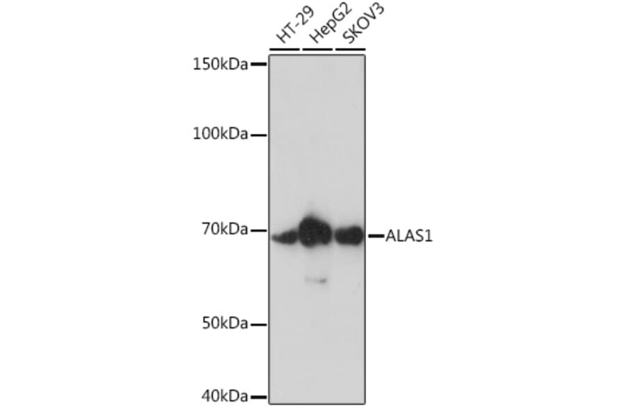 Western Blot - Anti-Alas1 Antibody [ARC0239] (A308881) - Antibodies.com