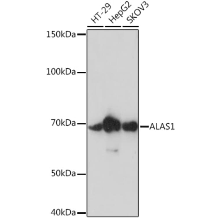 Western Blot - Anti-Alas1 Antibody [ARC0239] (A308881) - Antibodies.com