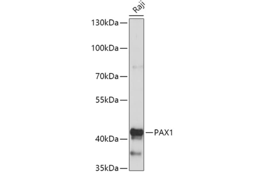 Western Blot - Anti-PAX1 Antibody (A308883) - Antibodies.com