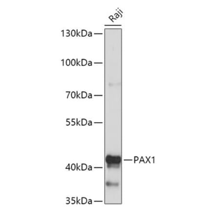 Western Blot - Anti-PAX1 Antibody (A308883) - Antibodies.com