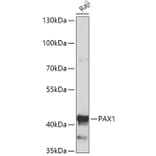 Western Blot - Anti-PAX1 Antibody (A308883) - Antibodies.com