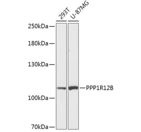 Western Blot - Anti-PPP1R12B Antibody (A308884) - Antibodies.com