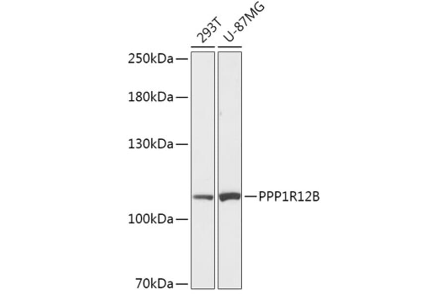Western Blot - Anti-PPP1R12B Antibody (A308884) - Antibodies.com