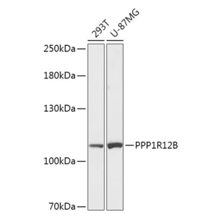 Western Blot - Anti-PPP1R12B Antibody (A308884) - Antibodies.com
