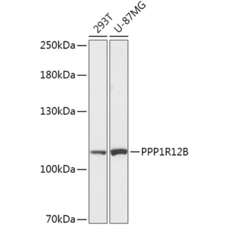 Western Blot - Anti-PPP1R12B Antibody (A308884) - Antibodies.com