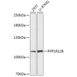 Western Blot - Anti-PPP1R12B Antibody (A308884) - Antibodies.com
