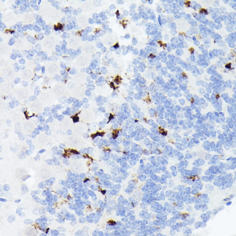 Immunohistochemistry - Anti-Somatostatin Antibody [ARC50670] (A308885) - Antibodies.com