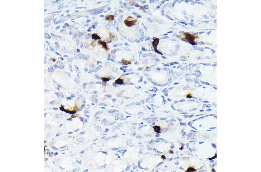 Immunohistochemistry - Anti-Somatostatin Antibody [ARC50670] (A308885) - Antibodies.com