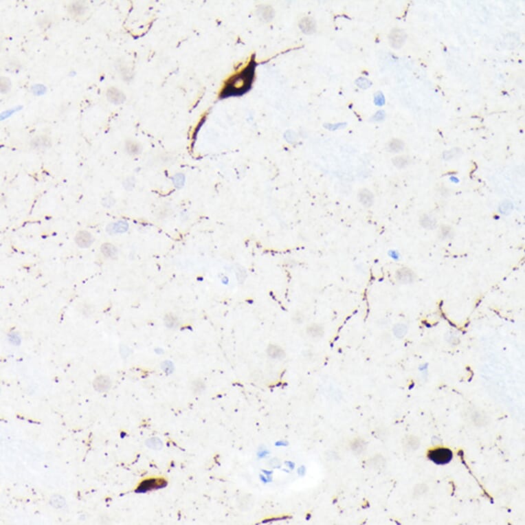 Immunohistochemistry - Anti-Somatostatin Antibody [ARC50670] (A308885) - Antibodies.com
