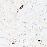Immunohistochemistry - Anti-Somatostatin Antibody [ARC50670] (A308885) - Antibodies.com