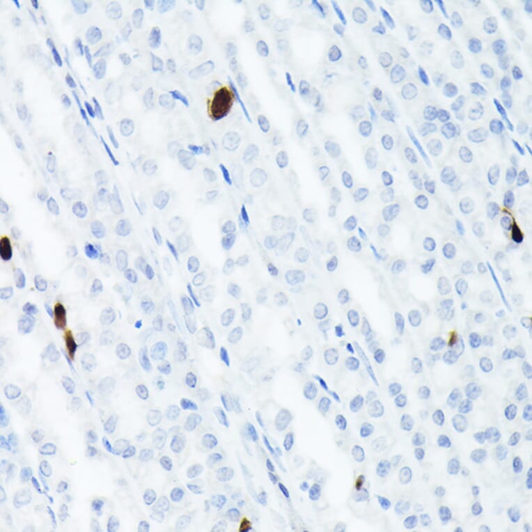 Immunohistochemistry - Anti-Somatostatin Antibody [ARC50670] (A308885) - Antibodies.com