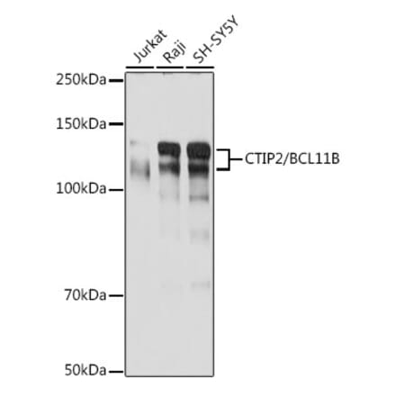 Western Blot - Anti-Ctip2 Antibody [ARC2329] (A308886) - Antibodies.com