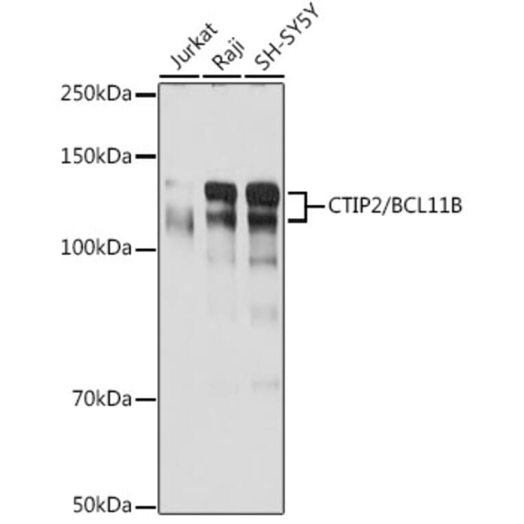 Western Blot - Anti-Ctip2 Antibody [ARC2329] (A308886) - Antibodies.com