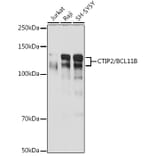 Western Blot - Anti-Ctip2 Antibody [ARC2329] (A308886) - Antibodies.com