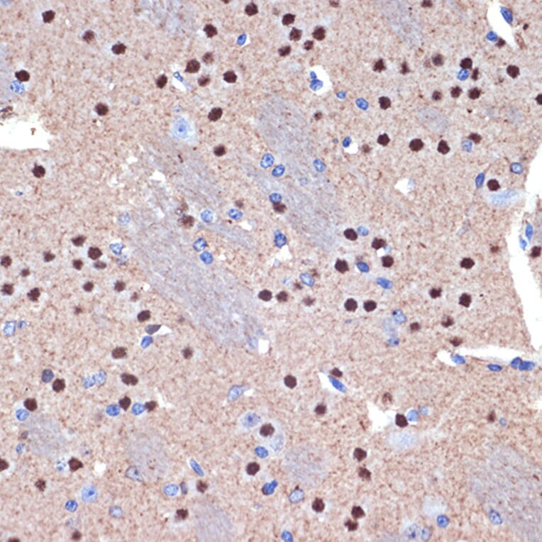 Immunohistochemistry - Anti-Ctip2 Antibody [ARC2329] (A308886) - Antibodies.com