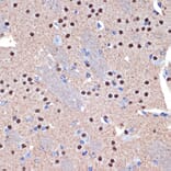 Immunohistochemistry - Anti-Ctip2 Antibody [ARC2329] (A308886) - Antibodies.com