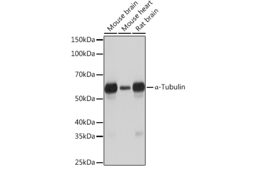 Western Blot - Anti-alpha Tubulin Antibody [ARC2486] (A308887) - Antibodies.com