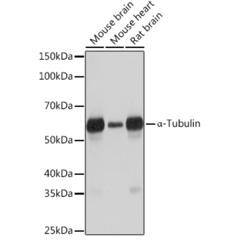 Western Blot - Anti-alpha Tubulin Antibody [ARC2486] (A308887) - Antibodies.com