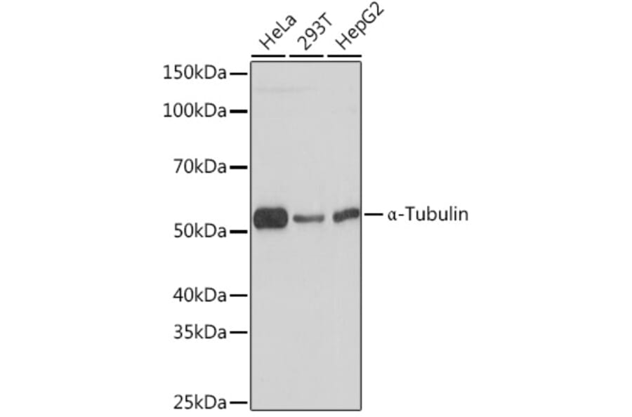 Western Blot - Anti-alpha Tubulin Antibody [ARC2486] (A308887) - Antibodies.com