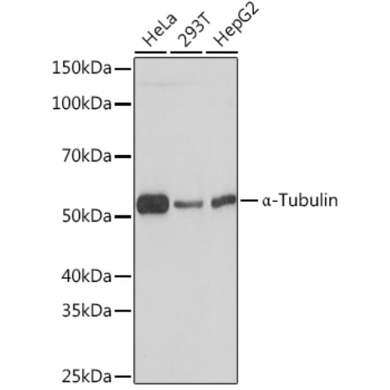 Western Blot - Anti-alpha Tubulin Antibody [ARC2486] (A308887) - Antibodies.com