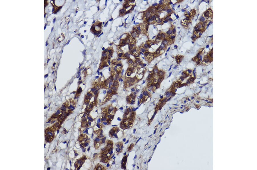 Immunohistochemistry - Anti-alpha Tubulin Antibody [ARC2486] (A308887) - Antibodies.com