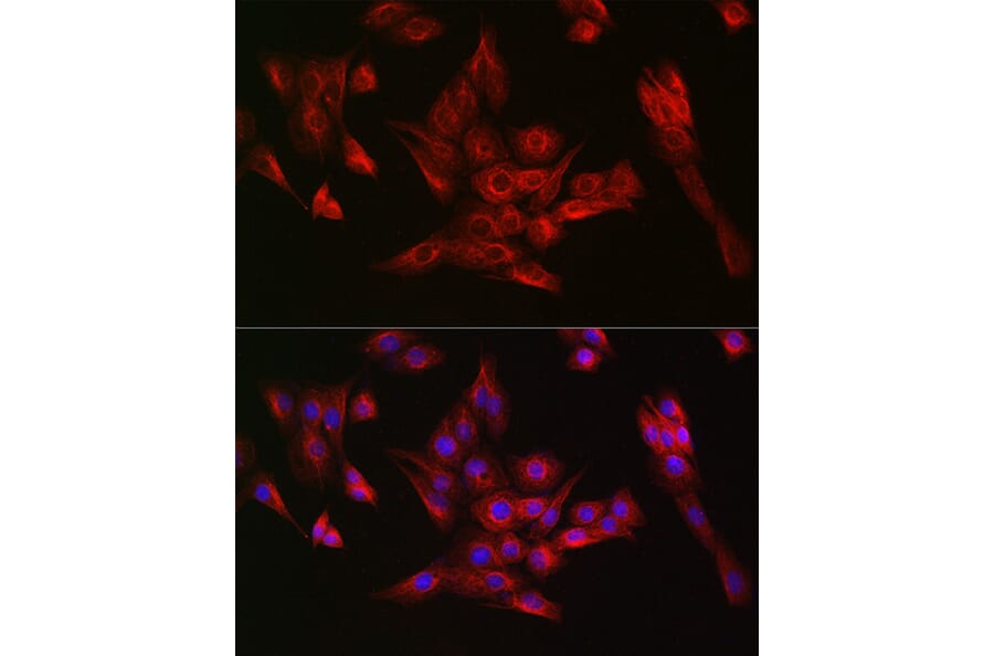 Immunofluorescence - Anti-alpha Tubulin Antibody [ARC2486] (A308887) - Antibodies.com