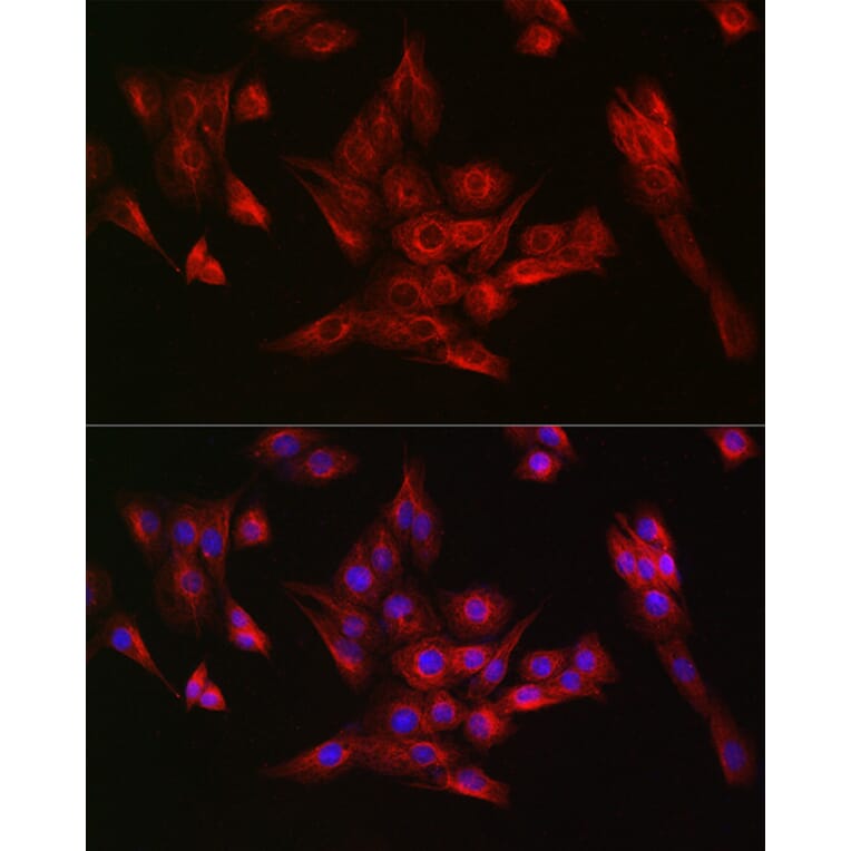 Immunofluorescence - Anti-alpha Tubulin Antibody [ARC2486] (A308887) - Antibodies.com
