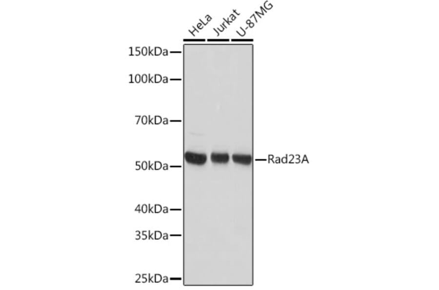 Western Blot - Anti-hHR23A Antibody [ARC1271] (A308889) - Antibodies.com