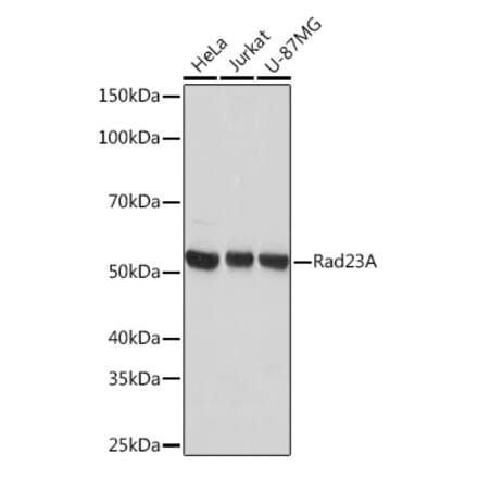 Western Blot - Anti-hHR23A Antibody [ARC1271] (A308889) - Antibodies.com