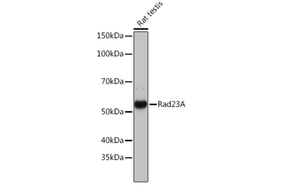 Western Blot - Anti-hHR23A Antibody [ARC1271] (A308889) - Antibodies.com