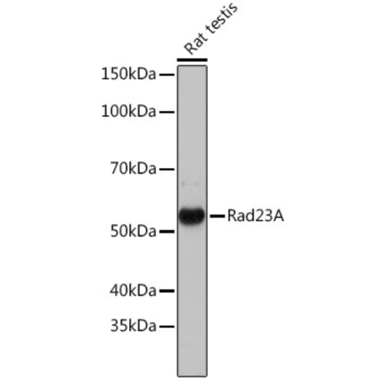 Western Blot - Anti-hHR23A Antibody [ARC1271] (A308889) - Antibodies.com