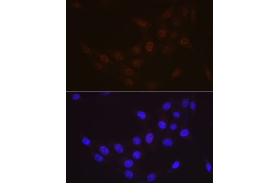Immunofluorescence - Anti-hHR23A Antibody [ARC1271] (A308889) - Antibodies.com