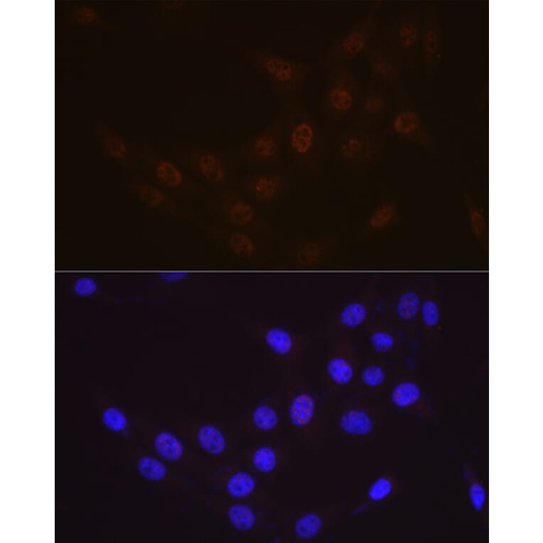 Immunofluorescence - Anti-hHR23A Antibody [ARC1271] (A308889) - Antibodies.com