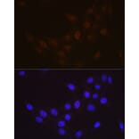 Immunofluorescence - Anti-hHR23A Antibody [ARC1271] (A308889) - Antibodies.com