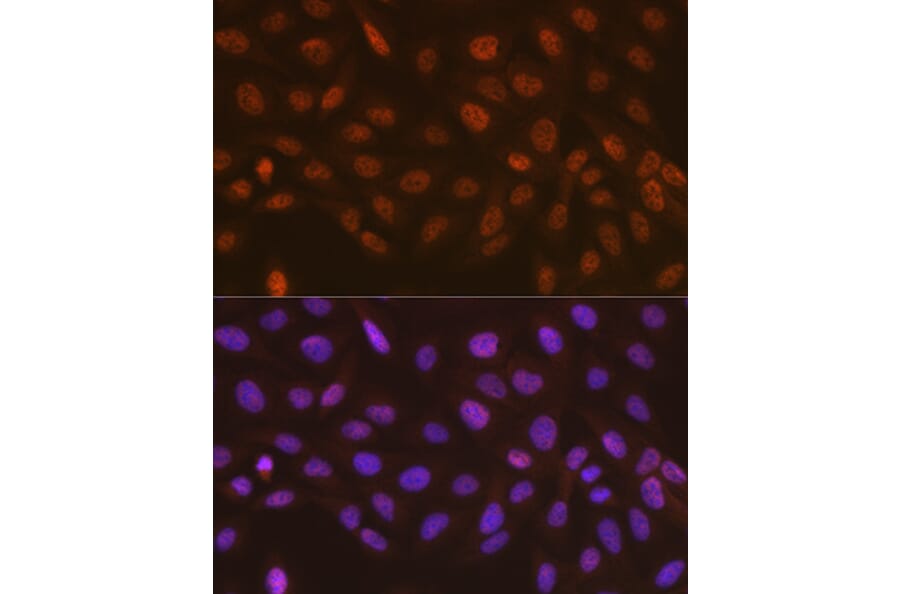 Immunofluorescence - Anti-hHR23A Antibody [ARC1271] (A308889) - Antibodies.com