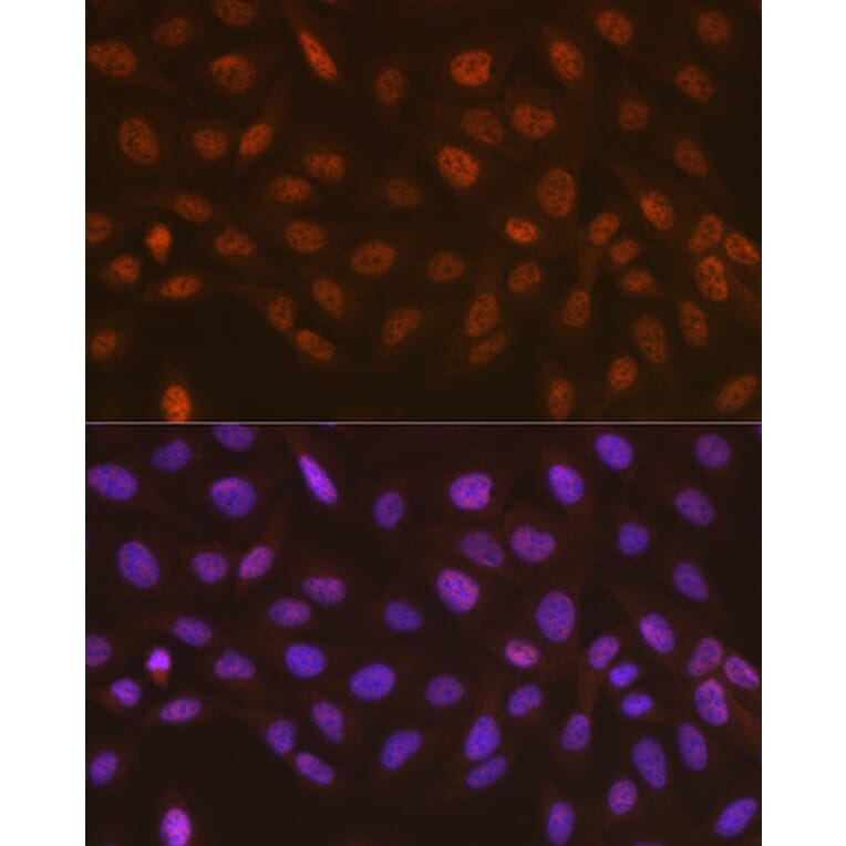Immunofluorescence - Anti-hHR23A Antibody [ARC1271] (A308889) - Antibodies.com