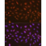 Immunofluorescence - Anti-hHR23A Antibody [ARC1271] (A308889) - Antibodies.com
