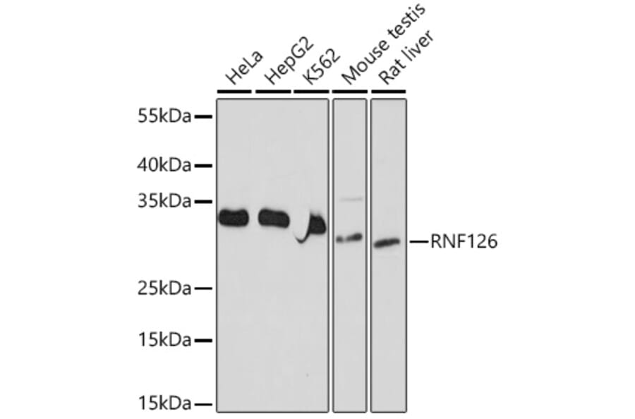 Western Blot - Anti-RNF126 Antibody (A308891) - Antibodies.com