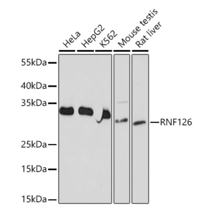 Western Blot - Anti-RNF126 Antibody (A308891) - Antibodies.com