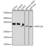 Western Blot - Anti-RNF126 Antibody (A308891) - Antibodies.com