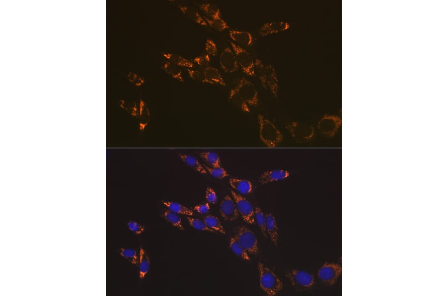 Immunofluorescence - Anti-RNF126 Antibody (A308891) - Antibodies.com