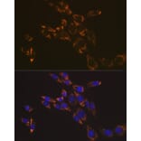 Immunofluorescence - Anti-RNF126 Antibody (A308891) - Antibodies.com