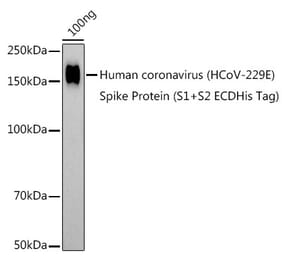 Western Blot - Anti-Human Coronavirus Spike glycoprotein Antibody (A308892) - Antibodies.com