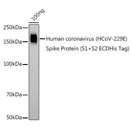 Western Blot - Anti-Human Coronavirus Spike glycoprotein Antibody (A308892) - Antibodies.com