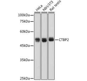 Western Blot - Anti-CTBP2 Antibody [ARC2509] (A308893) - Antibodies.com