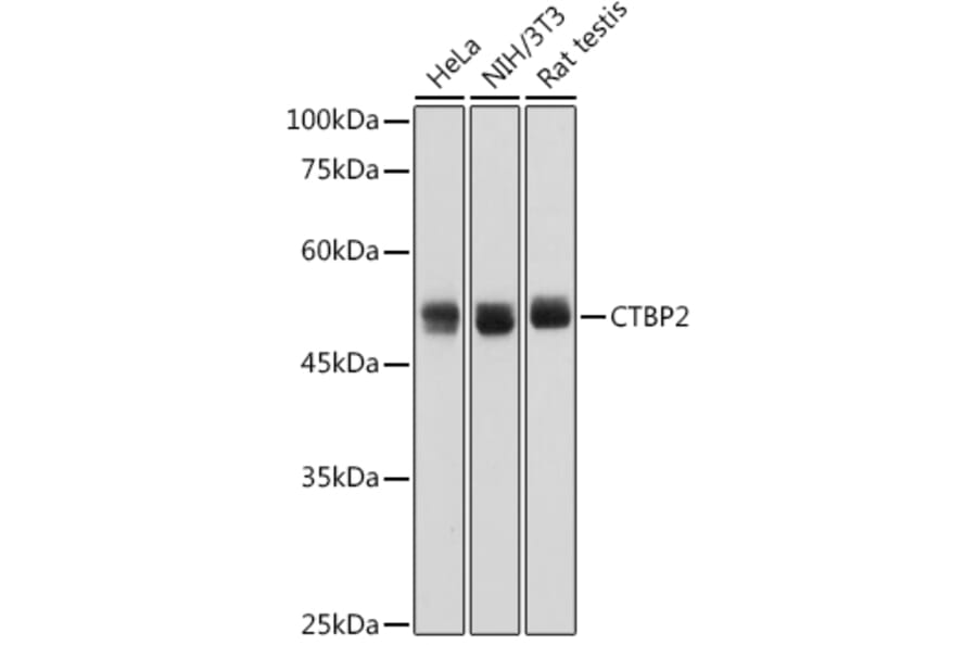 Western Blot - Anti-CTBP2 Antibody [ARC2509] (A308893) - Antibodies.com